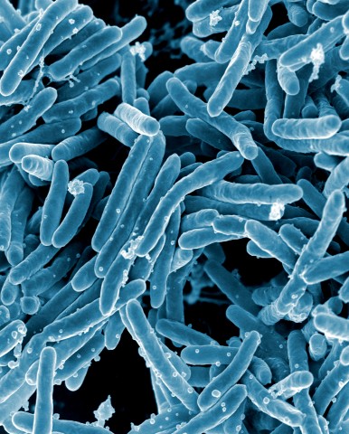 Rasterelektronenmikroskopische Aufnahme des für Tuberkulose verantwortlichen Mycobacterium tuberculosis.