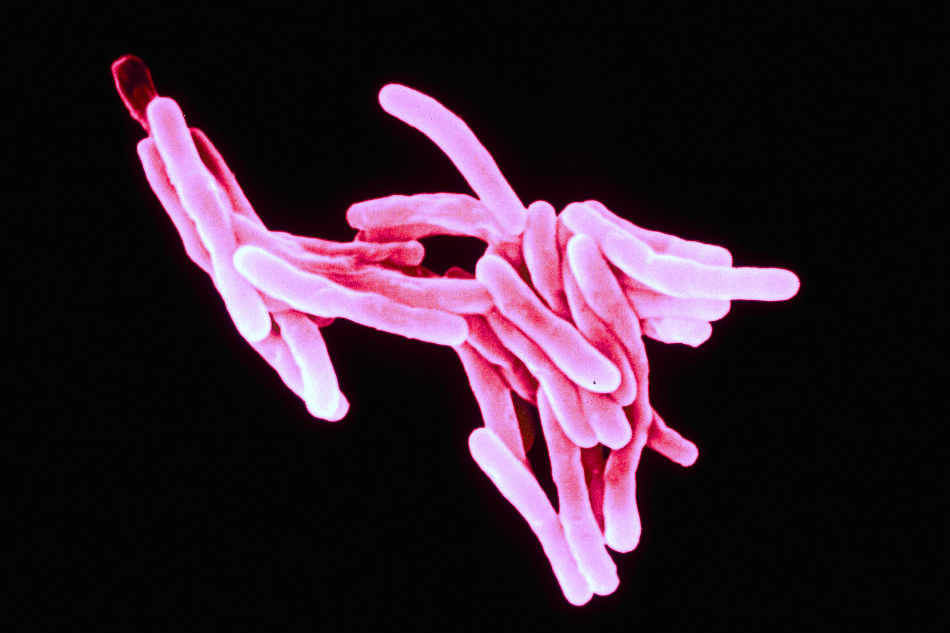 Rasterelektronenmikroskopische Aufnahme des für Tuberkulose verantwortlichen Mycobacterium tuberculosis.
