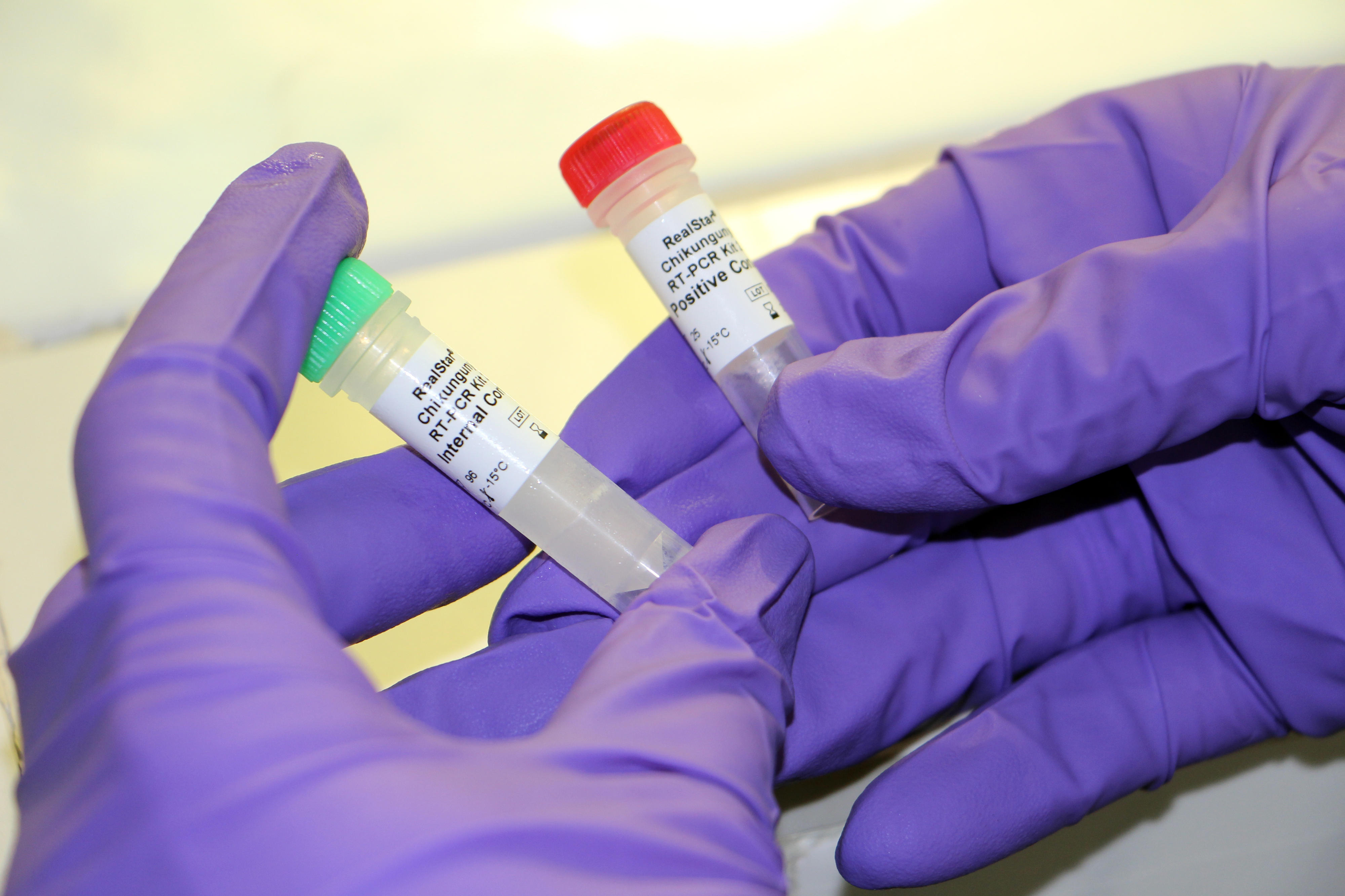 SEEG-Einsatz Benin, 2017: Reagenzien zum Nachweis von Chikungunya-Viren mit einer molekularbiologischen Untersuchungstechnik (Polymerase-Kettenreaktion)