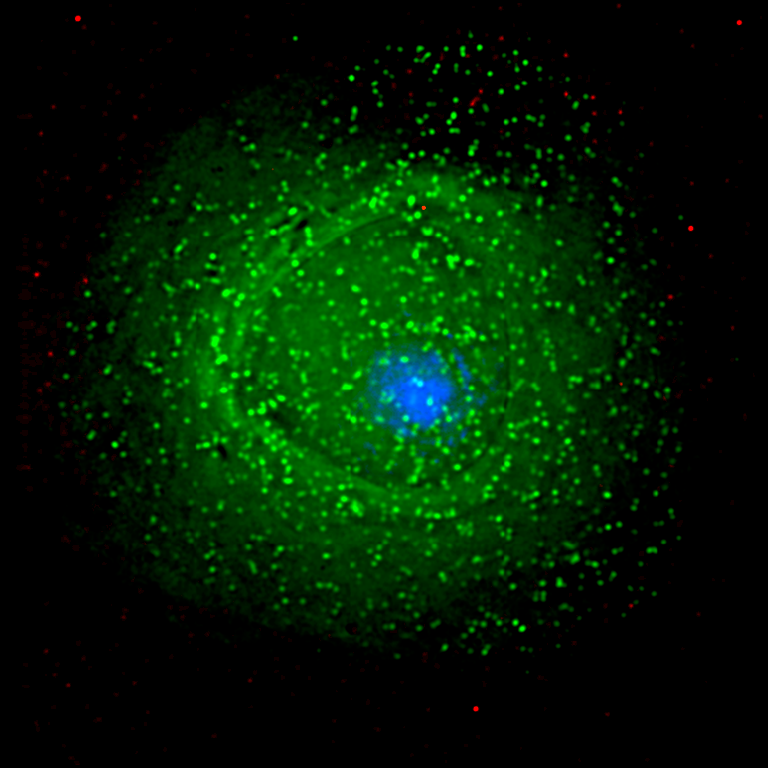 Elektronenmikroskopische Aufnahme einer Immunzelle, die mit HI-Viren infiziert ist. Die Viren sind durch einen fluoreszierenden Farbstoff hervorgehoben.