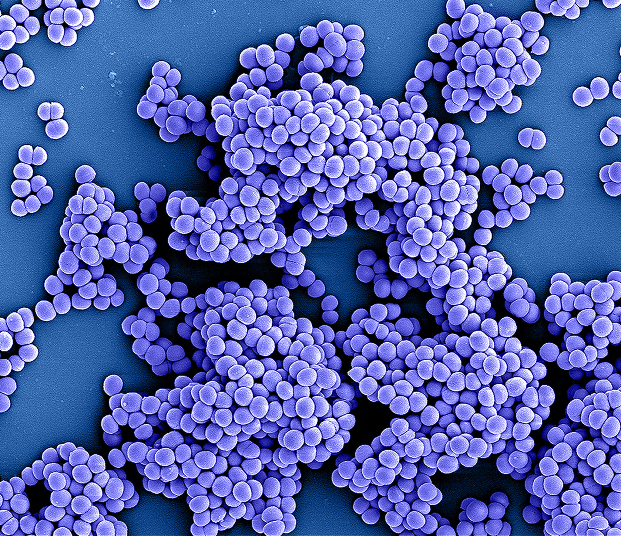 Koloriertes Bild von Methicillin-resistenten Staphylococcus aureus (MRSA)-Bakterien; aus einer rasterelektronenmikroskopischen Aufnahme, die in der NIAID Integrated Research Facility (IRF) in Fort Detrick, Maryland, aufgenommen wurde