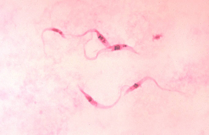 The microscopic image shows *Trypanosoma cruzi* in a blood smear.
