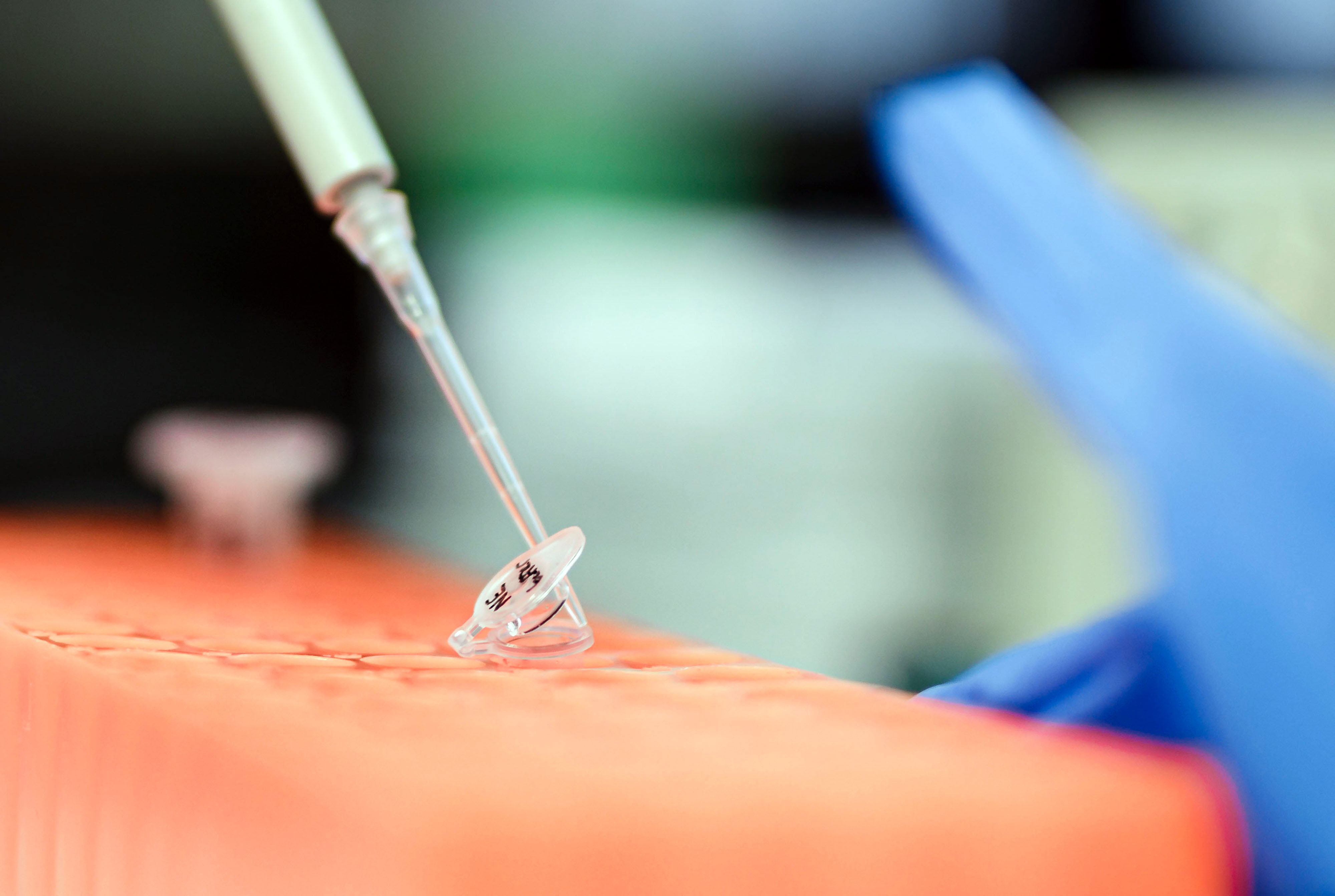 Laboruntersuchung einer Patientenprobe: Pipette und Probenröhrchen