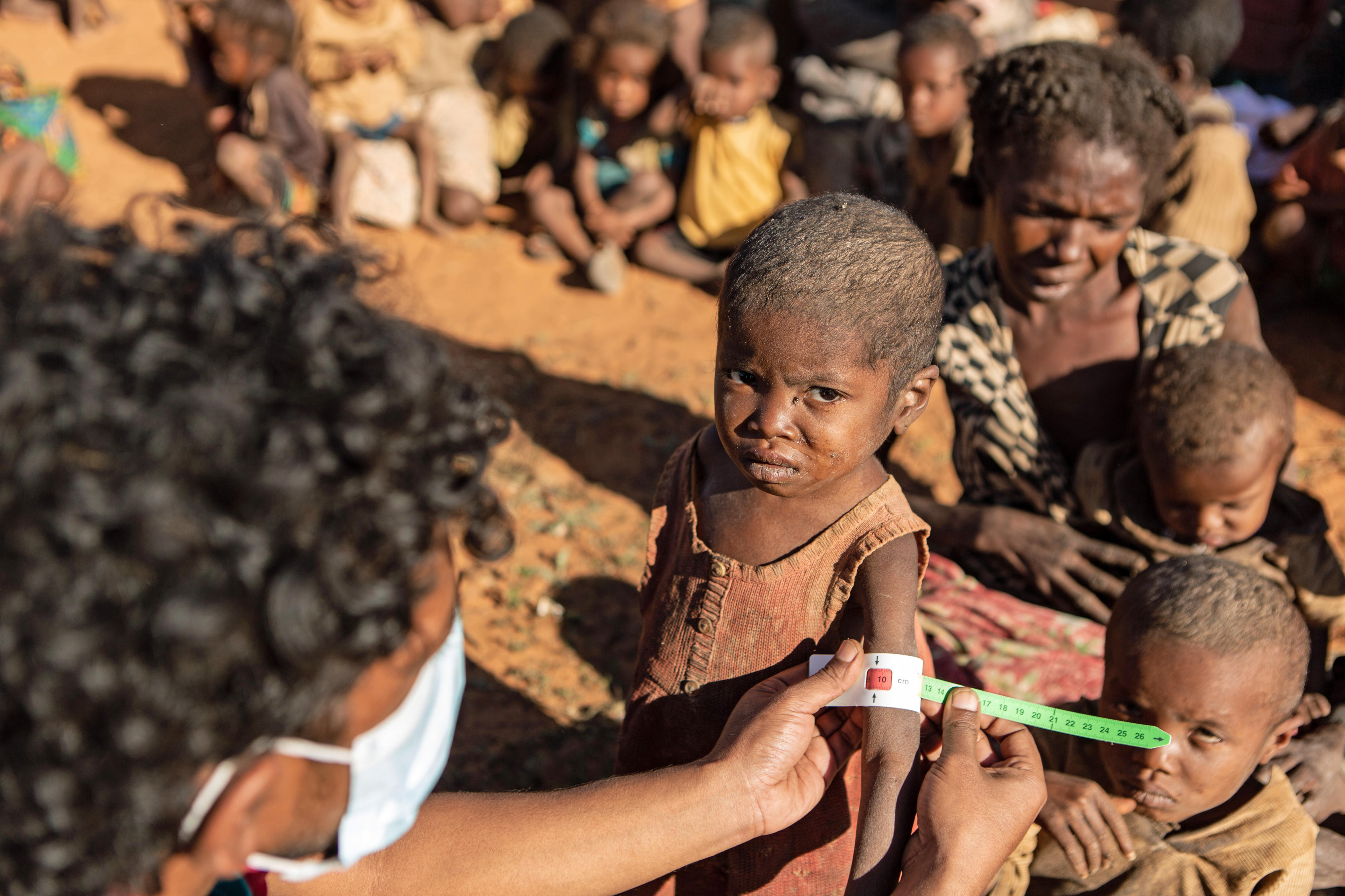 In Ambovombe, Madagaskar, bestimmt ein Mitarbeiter des Welternährungsprogramms mit einem speziellen Maßband den Grad der Mangelernährung eines vierjährigen Kindes.